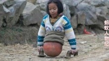 4岁小女孩因车祸失去双腿，靠一个篮球最终浴火重生！