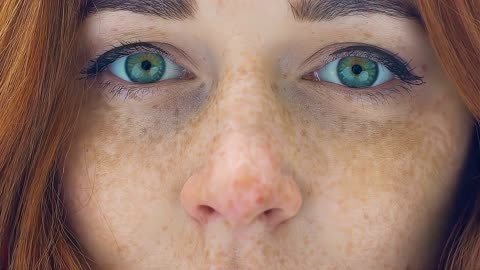肝斑又叫黄褐斑,一种写在女人脸上的病,长肝斑怎么办?