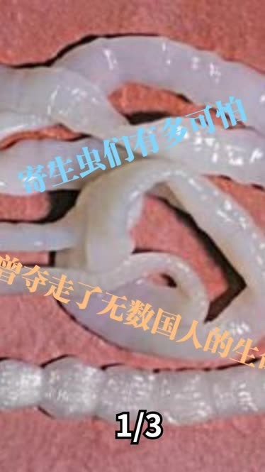 寄生虫长什么样子图片