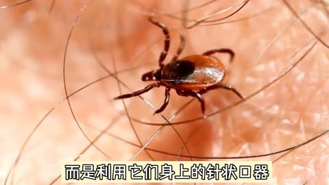 虫虫寄生图片